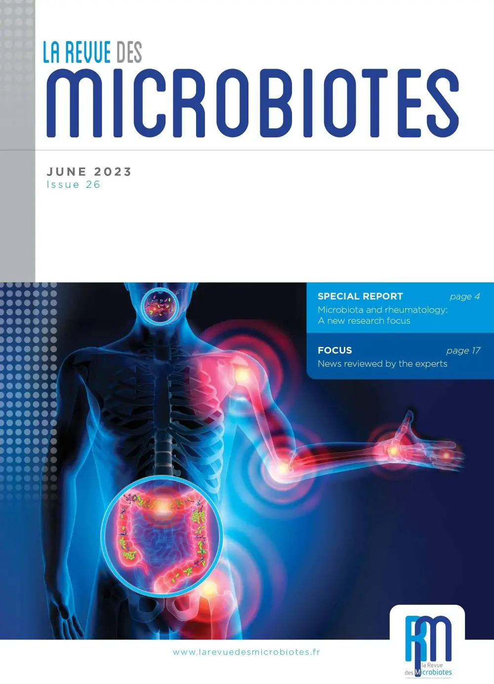 Microbiota and rheumatology: A new research focus